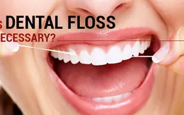 Chỉ nha khoa thật sự có khả năng ngăn ngừa bệnh răng miệng?