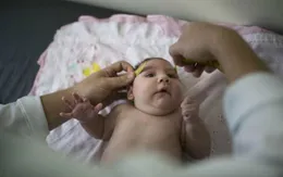 Thêm bằng chứng virus Zika gây chứng đầu nhỏ