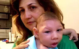 Virus Zika gây dị tật qua đường nhau thai