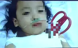 Cứu sống bé gái 5 tuổi bị kéo đâm thấu ngực tại TP.HCM