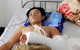 Thanh niên bị máy hút lúa cuốn tại Cần Thơ không phải tháo khớp tay
