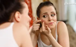 Bài thuốc tự nhiên trị mụn trứng cá