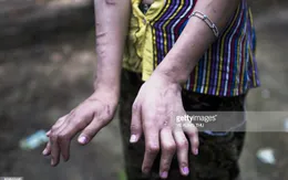 Vấn nạn bạo hành trẻ em tại Myanmar