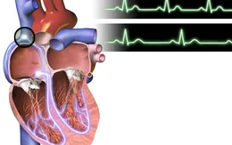 Nhịp tim chậm không làm tăng nguy cơ bị bệnh tim mạch