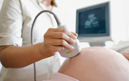 Nguy cơ trẻ bị dị tật tim bẩm sinh ở mức cao