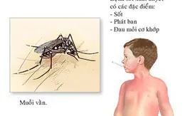 Hướng dẫn xử trí khi bị sốt xuất huyết