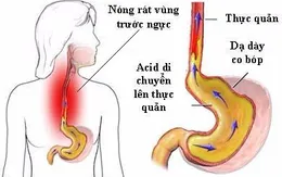 Tại sao bệnh dạ dày hay tái phát vào mùa thu?