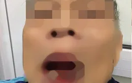 Cách chức cán bộ Sở Ngoại vụ hành hung người già