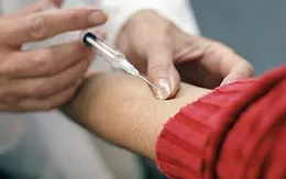 Nguy hiểm tính mạng do bệnh uốn ván nếu chưa tiêm phòng