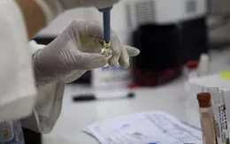 Vaccine phòng Zika dự kiến được công bố trong tháng 10