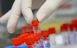 Dịch vụ tự xét nghiệm HIV tại Việt Nam