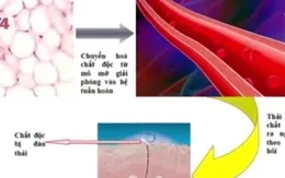 Phương pháp Hubbard hỗ trợ giải độc dioxin