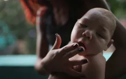 Em bé Việt có dị tật bẩm sinh nghi mắc chứng đầu nhỏ