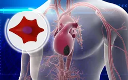 Tìm ra loại protein có thể giúp điều trị tổn thương tim