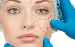 4 lời  khuyên để có ca phẫu thuật thẩm mỹ an toàn