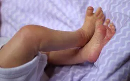 Vì sao bạn cảm thấy ngứa ngáy nhiều vào mùa đông?
