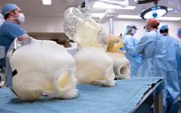 Mô hình 3D giúp phẫu thuật thực hành não