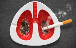 96,8% các ca ung thư phổi có liên quan đến thuốc lá