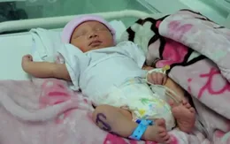 TP.HCM: Phẫu thuật cứu sống thai nhi bị dây rốn cuốn cổ có nguy cơ tử vong cao