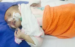 Hướng dẫn cách phát hiện bệnh ho gà