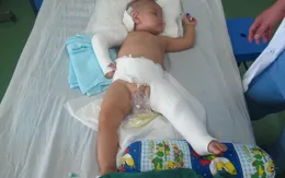 Cứu sống bé 15 tháng tuổi bị rơi từ tầng 5
