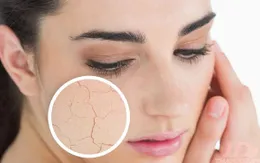Mùa đông, nên ăn những loại thực phẩm này để tránh khô da
