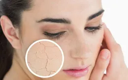 Làm cách nào để giữ làn da mịn màng trong mùa lạnh?