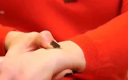 Miếng dán thay thế kim tiêm vaccine