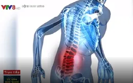 Phương pháp điều trị bệnh đau thắt lưng