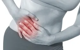 Viêm ruột thừa có thể đe dọa tính mạng