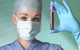 Xét nghiệm máu xác định tái phát ung thư vú