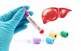 Lo ngại tình trạng lây lan viêm gan A trong cộng đồng người vô gia cư tại Mỹ