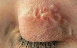 Phòng bệnh giun đũa từ chó, mèo