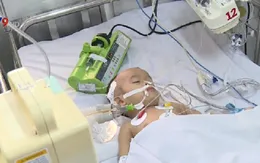 Bệnh nhi 30 tháng tuổi tử vong tại TP.HCM âm tính với virus viêm não mô cầu