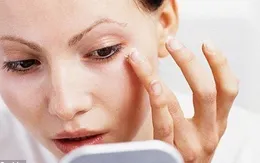 Lão hóa da - Nguyên nhân và dấu hiệu nhận biết