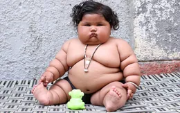 Ấn Độ: Bé gái 8 tháng nặng... 17kg