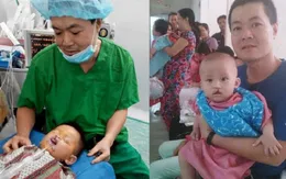 “Nụ cười nhân ái” phẫu thuật miễn phí cho trẻ dị tật ở miền Trung - Tây Nguyên