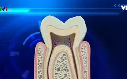 Bảo vệ răng nhạy cảm bằng chiết xuất từ trà xanh