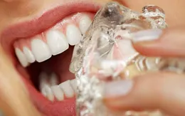 9 thói quen đang phá hỏng răng của bạn mỗi ngày