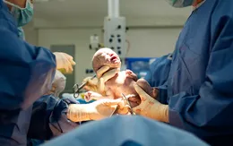 Sinh mổ và những điều cần biết