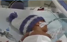 Phương pháp mới chẩn đoán bệnh ở trẻ sinh non