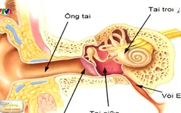 Suy giảm thính lực ở người cao tuổi