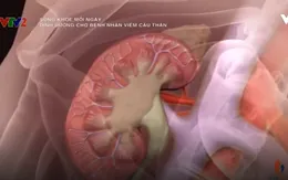 Chế độ dinh dưỡng cho bệnh nhân viêm cầu thận cấp