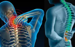 5 năm “làm lại” cuộc đời sau thời gian dài sống với thoát vị đĩa đệm