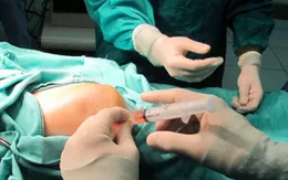 Bước tiến mới trong điều trị thoái hóa khớp