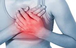 Gần 1/2 các cơn đau tim không có triệu chứng ở ngực