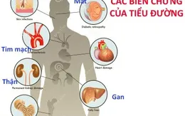 Việt Nam thuộc top các nước có tỷ lệ gia tăng bệnh tiểu đường cao nhất thế giới