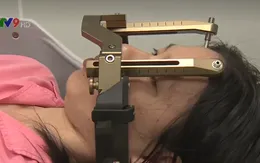 Nhiều ưu điểm nổi bật trong điều trị u não bằng ứng dụng Gamma Knife