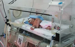 Những lưu ý khi vệ sinh rốn cho trẻ sơ sinh
