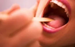 Viêm họng do vi khuẩn - Dùng thuốc gì?